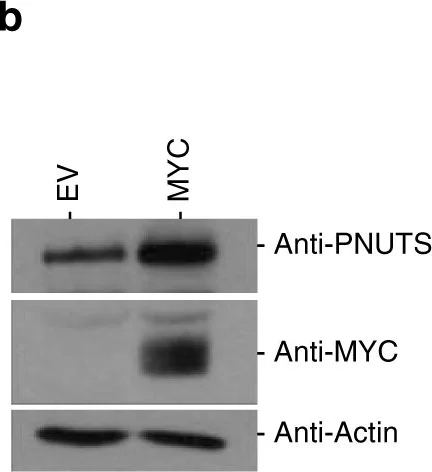 Western blot - Anti-c-Myc (phospho S62) antibody [33A12E10] (AB78318)