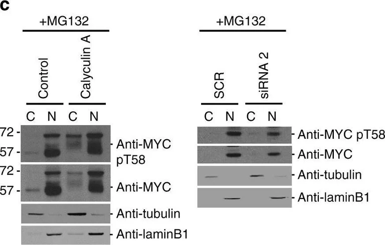 Western blot - Anti-c-Myc (phospho S62) antibody [33A12E10] (AB78318)