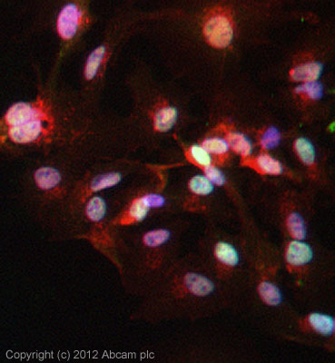 Immunocytochemistry/ Immunofluorescence - Anti-c-Myc (phospho S62) antibody (AB51156)