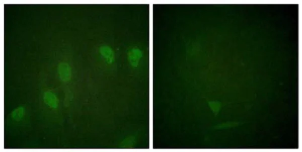 Immunocytochemistry/ Immunofluorescence - Anti-c-Myc (phospho S62) antibody (AB51156)