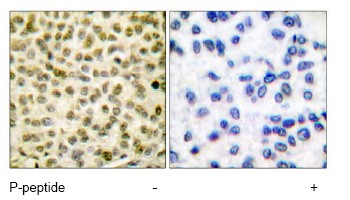Immunohistochemistry (Formalin/PFA-fixed paraffin-embedded sections) - Anti-c-Myc (phospho S62) antibody (AB51156)