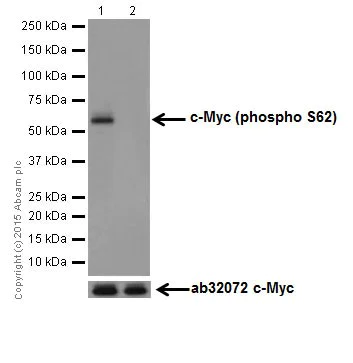 Western blot - Anti-c-Myc (phospho S62) antibody [EPR17924] (AB185656)