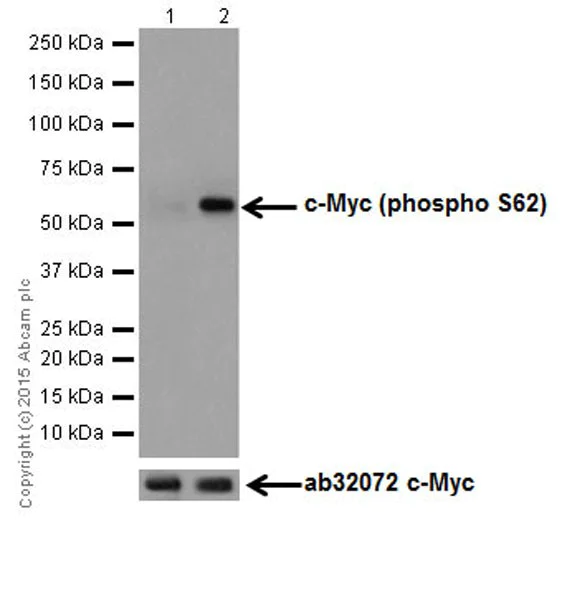 Western blot - Anti-c-Myc (phospho S62) antibody [EPR17924] (AB185656)