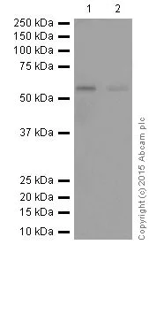 Western blot - Anti-c-Myc (phospho S62) antibody [EPR17924] (AB185656)