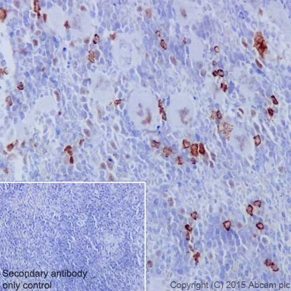Immunohistochemistry (Formalin/PFA-fixed paraffin-embedded sections) - Anti-c-Myc (phospho S62) antibody [EPR17924] - BSA and Azide free (AB232691)