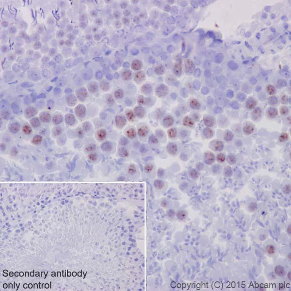 Immunohistochemistry (Formalin/PFA-fixed paraffin-embedded sections) - Anti-c-Myc (phospho S62) antibody [EPR17924] - BSA and Azide free (AB232691)