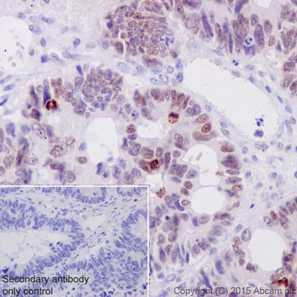 Immunohistochemistry (Formalin/PFA-fixed paraffin-embedded sections) - Anti-c-Myc (phospho S62) antibody [EPR17924] - BSA and Azide free (AB232691)