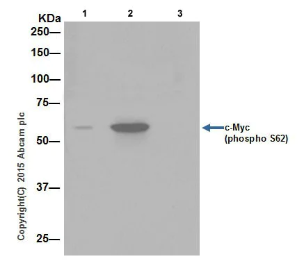 Immunoprecipitation - Anti-c-Myc (phospho S62) antibody [EPR17924] - BSA and Azide free (AB232691)