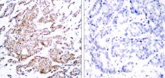 Immunohistochemistry (Formalin/PFA-fixed paraffin-embedded sections) - Anti-c-Myc (phospho T58) antibody (AB28842), expandable thumbnail