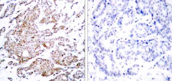 Immunohistochemistry (Formalin/PFA-fixed paraffin-embedded sections) - Anti-c-Myc (phospho T58) antibody (AB28842)