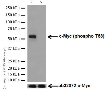 Western blot - Anti-c-Myc (phospho T58) antibody [EPR17923] (AB185655)