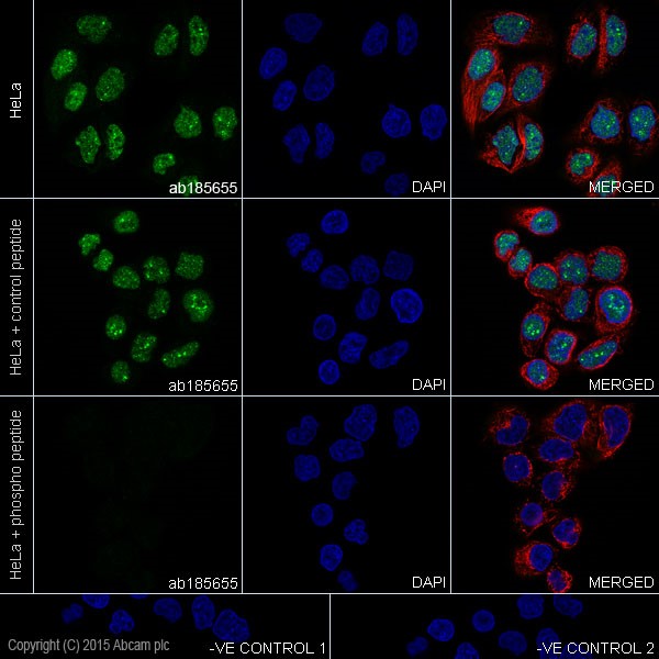 Immunocytochemistry/ Immunofluorescence - Anti-c-Myc (phospho T58) antibody [EPR17923] - BSA and Azide free (AB236021), expandable thumbnail