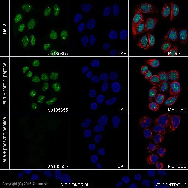 Immunocytochemistry/ Immunofluorescence - Anti-c-Myc (phospho T58) antibody [EPR17923] - BSA and Azide free (AB236021)
