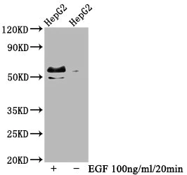 Western blot - Anti-c-Myc (phospho T58 + S62) antibody [4E9] (AB314029)
