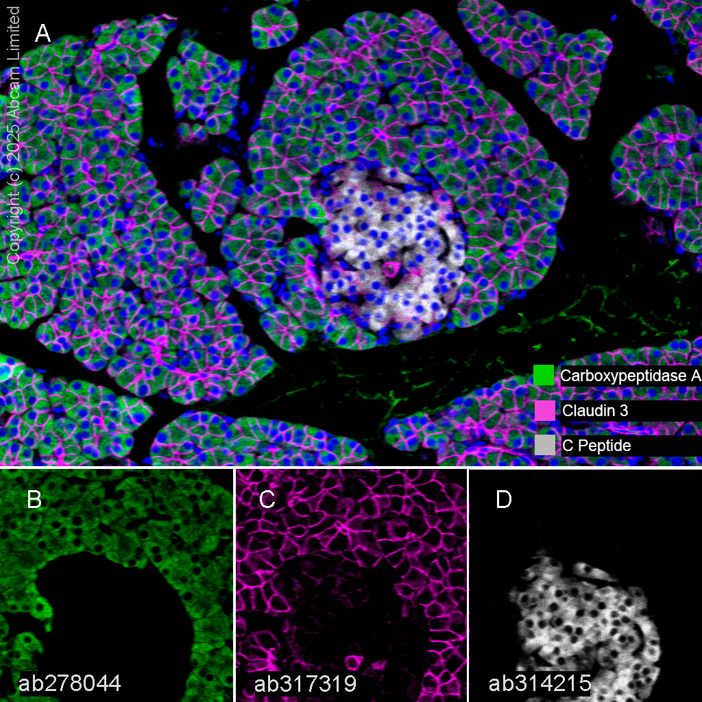 Multiplex immunohistochemistry - Anti-C Peptide antibody [EPR25854-146] - BSA and Azide free (ab314216), expandable thumbnail