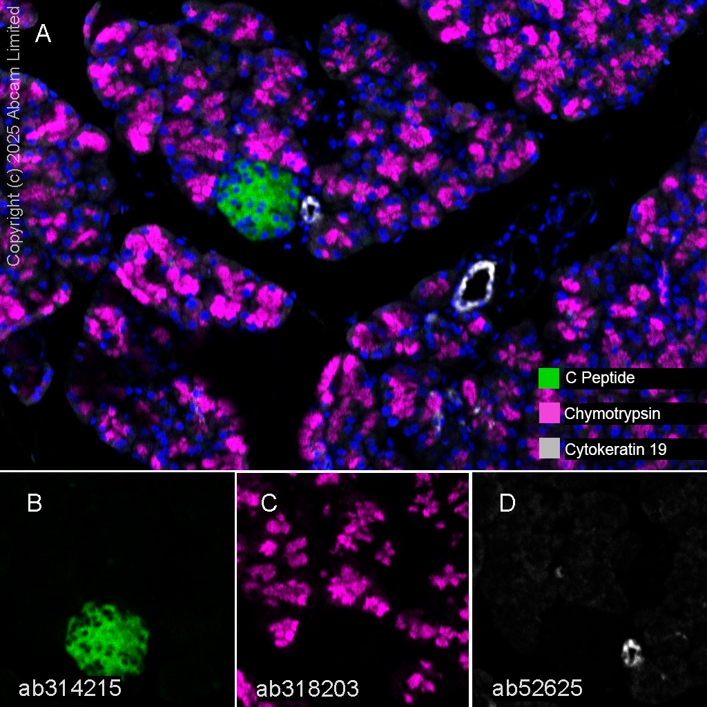 Multiplex immunohistochemistry - Anti-C Peptide antibody [EPR25854-146] - BSA and Azide free (AB314216), expandable thumbnail