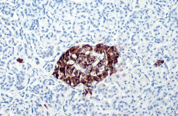 Immunohistochemistry - Anti-C-Peptide antibody [HL1158] (AB307800), expandable thumbnail