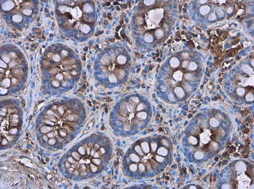 Immunohistochemistry (Formalin/PFA-fixed paraffin-embedded sections) - Anti-C Reactive Protein antibody (AB227507), expandable thumbnail