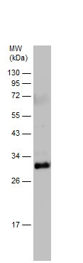 Western blot - Anti-C Reactive Protein antibody (AB227507), expandable thumbnail