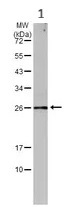 Western blot - Anti-C Reactive Protein antibody (AB227507)