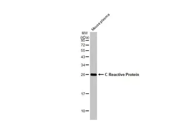 Western blot - Anti-C Reactive Protein antibody (AB227507)