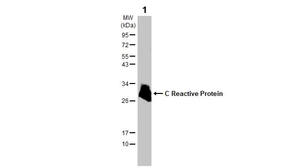 Western blot - Anti-C Reactive Protein antibody (AB227507)