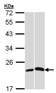 Western blot - Anti-C Reactive Protein antibody (AB227507), expandable thumbnail