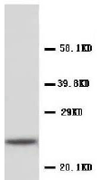 Western blot - Anti-C Reactive Protein antibody - Aminoterminal end (AB65842)