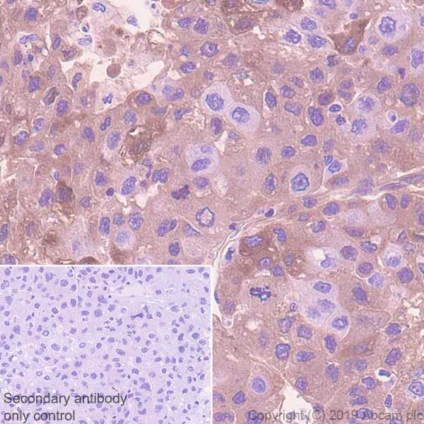 Immunohistochemistry (Formalin/PFA-fixed paraffin-embedded sections) - Anti-C Reactive Protein antibody [EPR22862-10] - BSA and Azide free (AB263020)