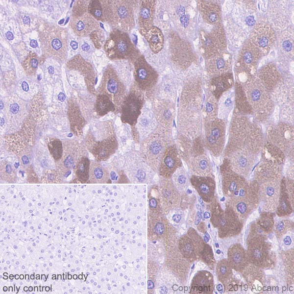 Immunohistochemistry (Formalin/PFA-fixed paraffin-embedded sections) - Anti-C Reactive Protein antibody [EPR22862-10] - BSA and Azide free (AB263020)