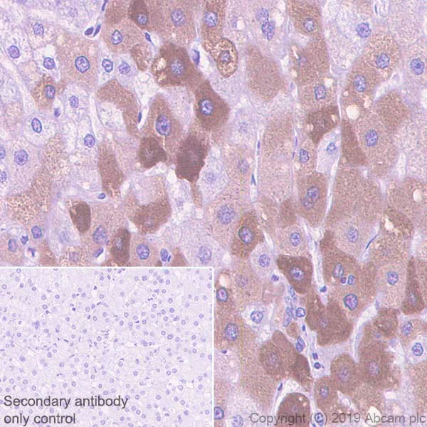 Immunohistochemistry (Formalin/PFA-fixed paraffin-embedded sections) - Anti-C Reactive Protein antibody [EPR22862-10] - BSA and Azide free (AB263020)
