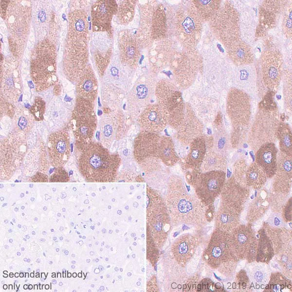 Immunohistochemistry (Formalin/PFA-fixed paraffin-embedded sections) - Anti-C Reactive Protein antibody [EPR22868-87] (AB256525)