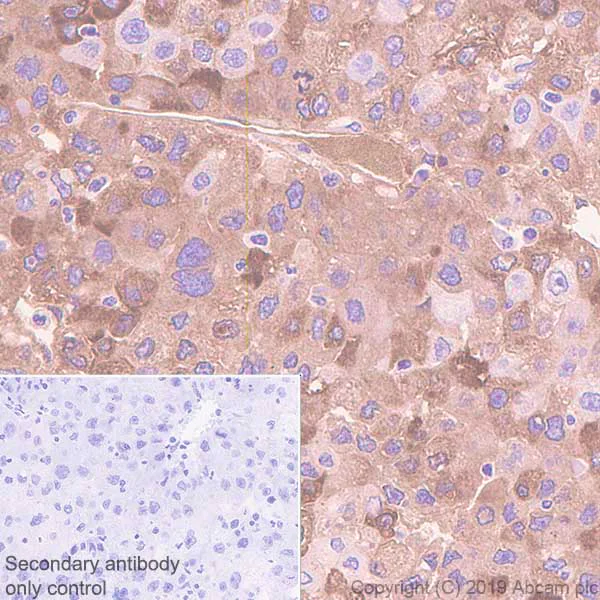 Immunohistochemistry (Formalin/PFA-fixed paraffin-embedded sections) - Anti-C Reactive Protein antibody [EPR22868-87] (AB256525)