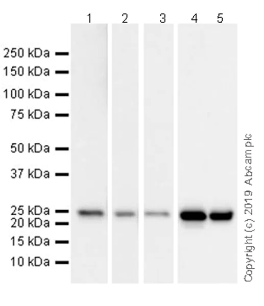 Western blot - Anti-C Reactive Protein antibody [EPR22868-87] (AB256525)