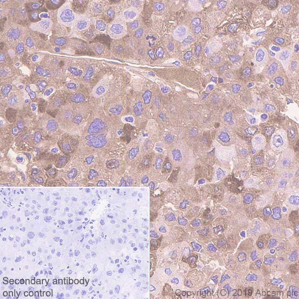 Immunohistochemistry (Formalin/PFA-fixed paraffin-embedded sections) - Anti-C Reactive Protein antibody [EPR22868-87] - BSA and Azide free (AB256546)