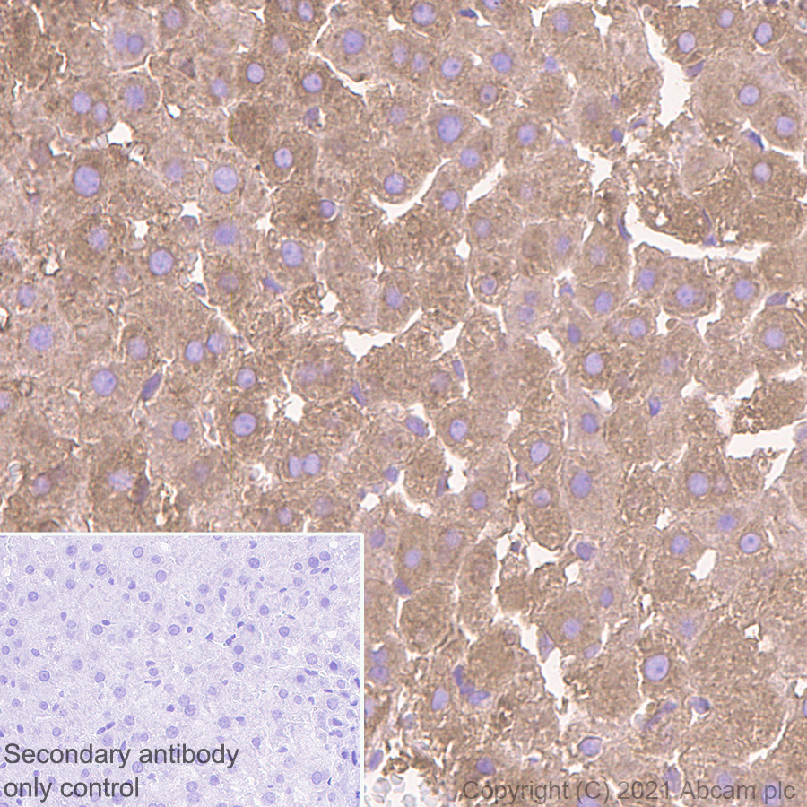 Immunohistochemistry (Formalin/PFA-fixed paraffin-embedded sections) - Anti-C Reactive Protein antibody [EPR23975-119] (AB259862), expandable thumbnail