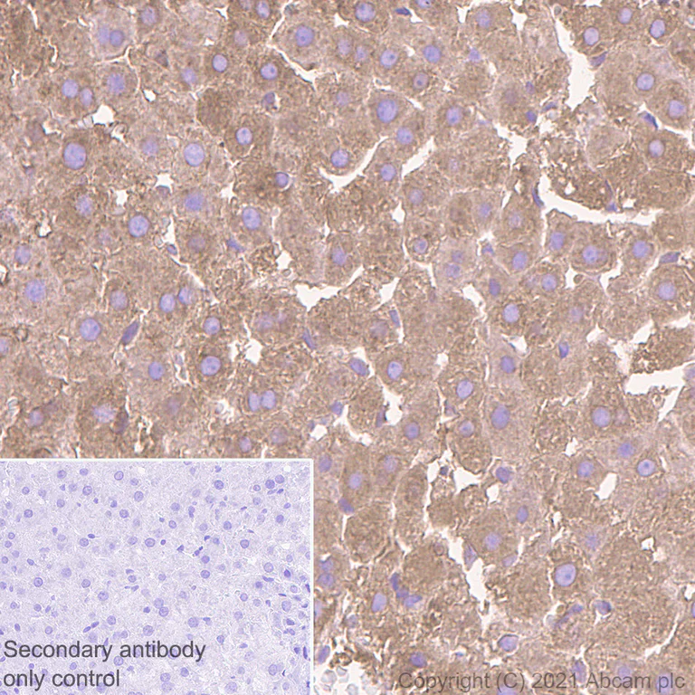 Immunohistochemistry (Formalin/PFA-fixed paraffin-embedded sections) - Anti-C Reactive Protein antibody [EPR23975-119] (AB259862)