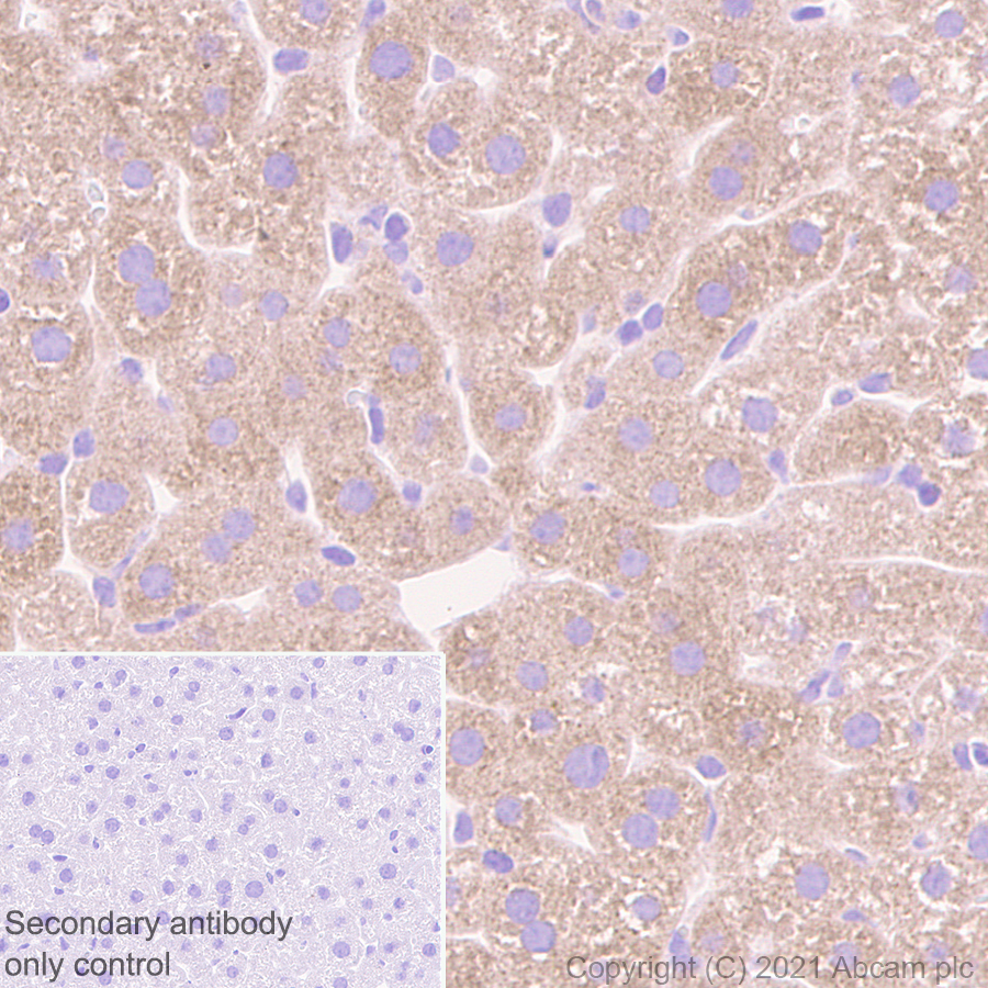 Immunohistochemistry (Formalin/PFA-fixed paraffin-embedded sections) - Anti-C Reactive Protein antibody [EPR23975-119] (AB259862), expandable thumbnail