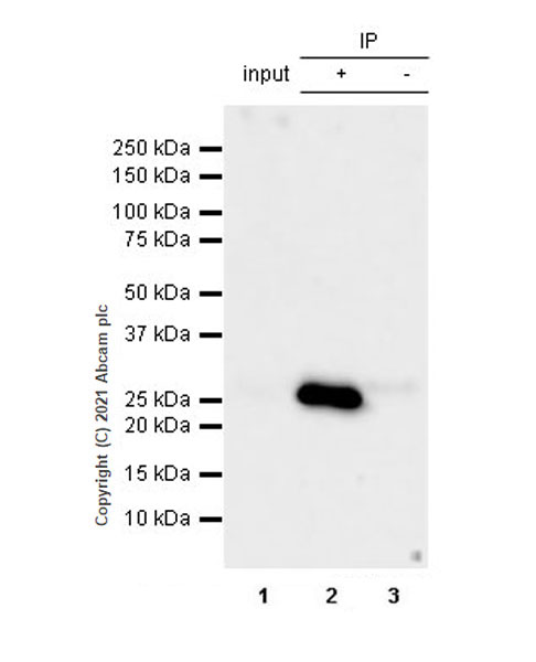 Immunoprecipitation - Anti-C Reactive Protein antibody [EPR23975-119] (AB259862), expandable thumbnail