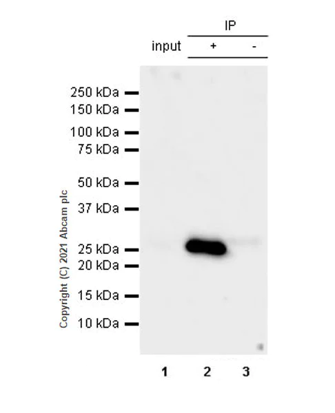 Immunoprecipitation - Anti-C Reactive Protein antibody [EPR23975-119] (AB259862)