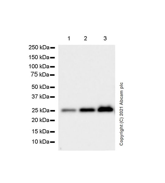 Western blot - Anti-C Reactive Protein antibody [EPR23975-119] (AB259862), expandable thumbnail