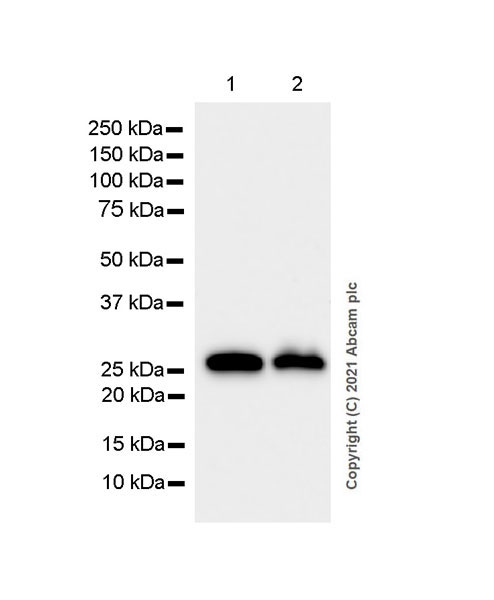 Western blot - Anti-C Reactive Protein antibody [EPR23975-119] (AB259862), expandable thumbnail