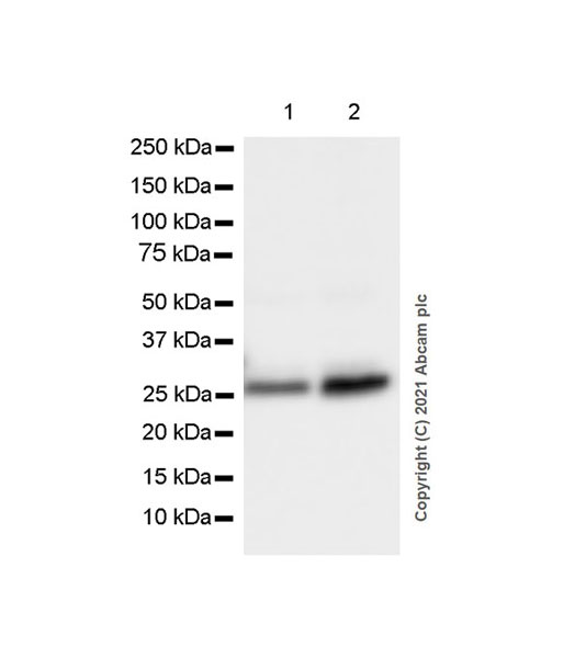 Western blot - Anti-C Reactive Protein antibody [EPR23975-119] (ab259862), expandable thumbnail