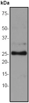 Western blot - Anti-C Reactive Protein antibody [EPR283Y] (AB51016)