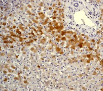 Immunohistochemistry (Formalin/PFA-fixed paraffin-embedded sections) - Anti-C Reactive Protein antibody [Y284] (AB32412), expandable thumbnail