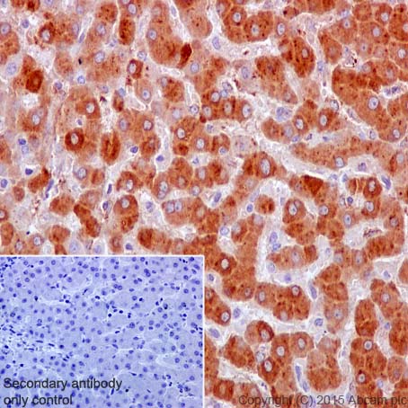 Immunohistochemistry (Formalin/PFA-fixed paraffin-embedded sections) - Anti-C Reactive Protein antibody [Y284] (AB32412), expandable thumbnail