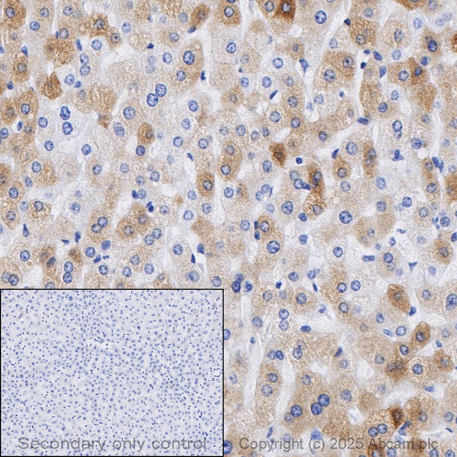Immunohistochemistry (Formalin/PFA-fixed paraffin-embedded sections) - Anti-C Reactive Protein antibody [Y284] (AB32412)