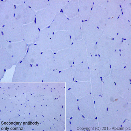 Immunohistochemistry (Formalin/PFA-fixed paraffin-embedded sections) - Anti-C Reactive Protein antibody [Y284] (AB32412), expandable thumbnail