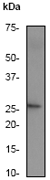 Western blot - Anti-C Reactive Protein antibody [Y284] (ab32412), expandable thumbnail