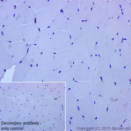 Immunohistochemistry (Formalin/PFA-fixed paraffin-embedded sections) - Anti-C Reactive Protein antibody [Y284] - BSA and Azide free (AB271830)